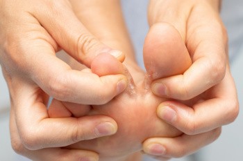 Understanding Athlete's Foot and How to Prevent It