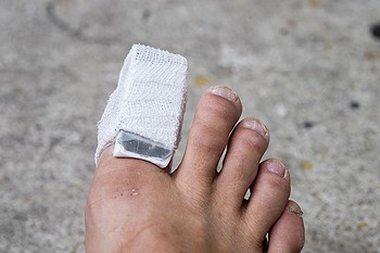What Can Be Done About Broken Toes